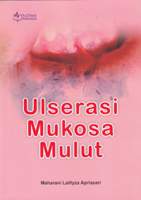 Ulserasi Mukosa Mulut