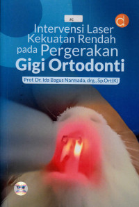 Image of Intervensi Laser Kekuatan Rendah pada Pergerakan Gigi Ortodonti