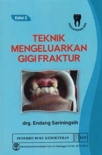 Teknik Mengeluarkan Gigi Fraktur