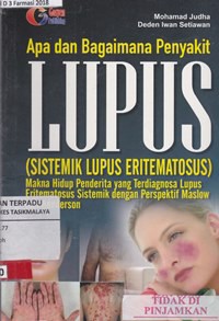 Image of Apa dan bagaimana penyakit lupus