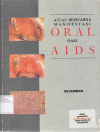 Image of Atlas Berwarna Manifestasi Oral Dari Aids