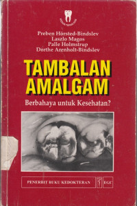 Tambalan Amalgam
