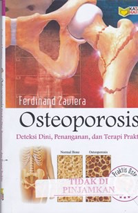 Osteoporosis deteksi dini, penanganan, dan terapi praktis