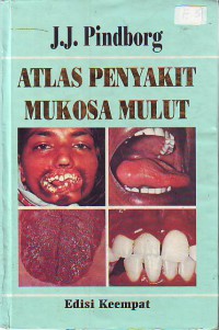 Atlas penyakit mukosa mulut