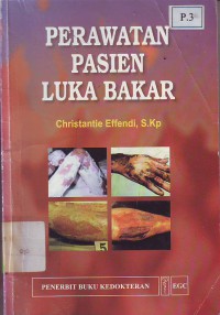 Image of Perawatan pasien luka bakar