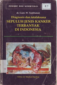 Sepuluh jenis kanker terbanyak di indonesia diagnosis dan tatalaksana