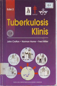 Tuberkulosis Klinis