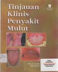 Image of Tinjauan Klinis Penyakit Mulut