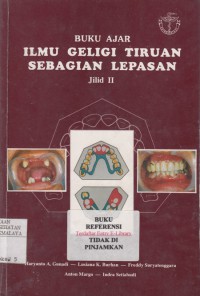 Buku Ajar Ilmu Geligi Tiruan Sebagian Lepasan Jilid II