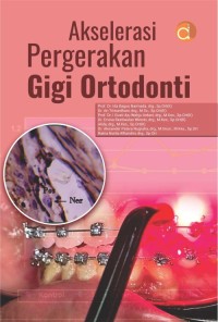 Image of Akselerasi Pergerakan Gigi Ortodonti