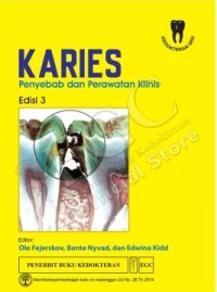 Image of Karies: Penyebab dan Perawatan Klinis