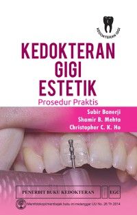 Image of Kedokteran Gigi Estetik: Prosedur Praktis