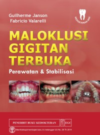 Image of Maloklusi Gigitan Terbuka: Perawatan dan Stabilitasi